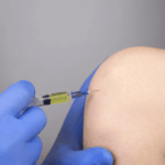Can PRP Injections Promote Cartilage Repair? post