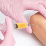 PRP for Golfers in Tampa: Treating Elbow and Shoulder Pain Without Surgery post